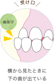 横から見たときに下の歯が出ている