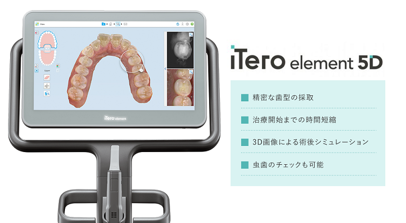 iTero element 5Ｄ」を使用するメリット