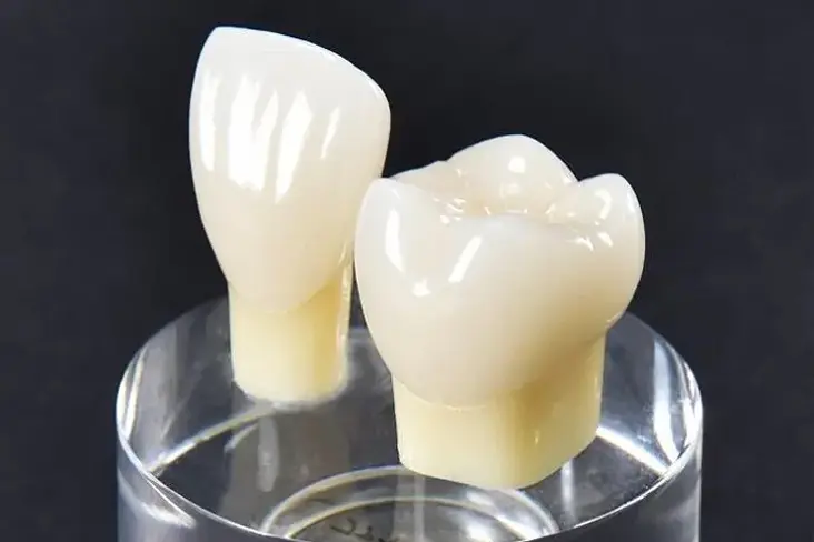 ジルコニア(インレー/クラウン)